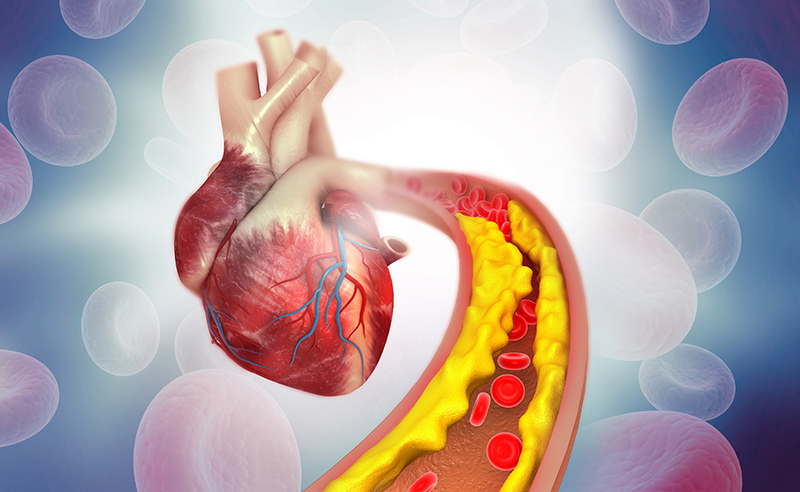Cholesterol là một chất béo tự nhiên trong cơ thể