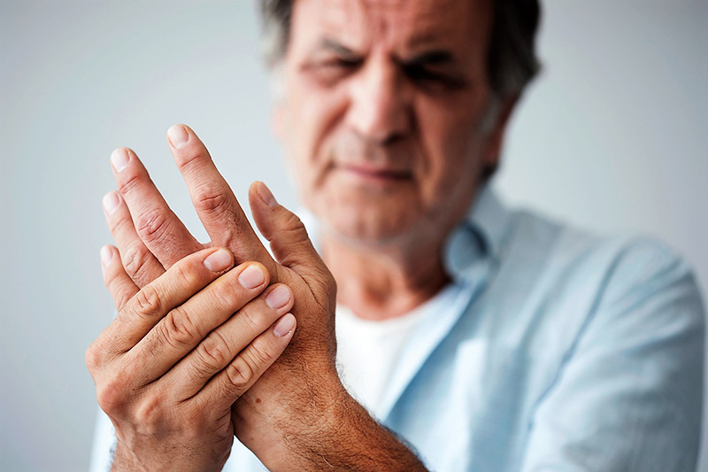 Viêm khớp thường xảy ra chủ yếu ở các khớp nhỏ như khớp bàn tay, ngón tay