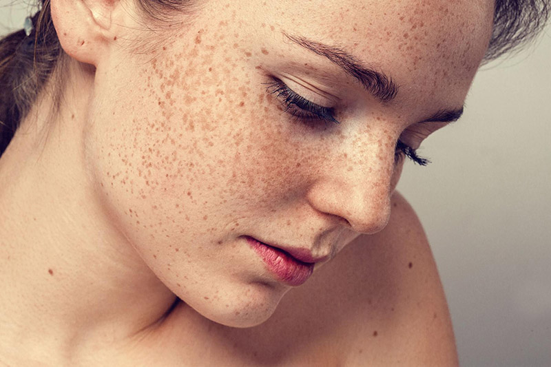 Hạn chế tiếp xúc với tia nắng mặt trời để ngăn ngừa vấn đề nám da với mẹ bầu